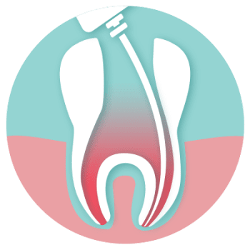 ENDODONCIA